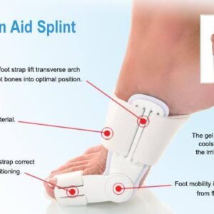 bunion splint
